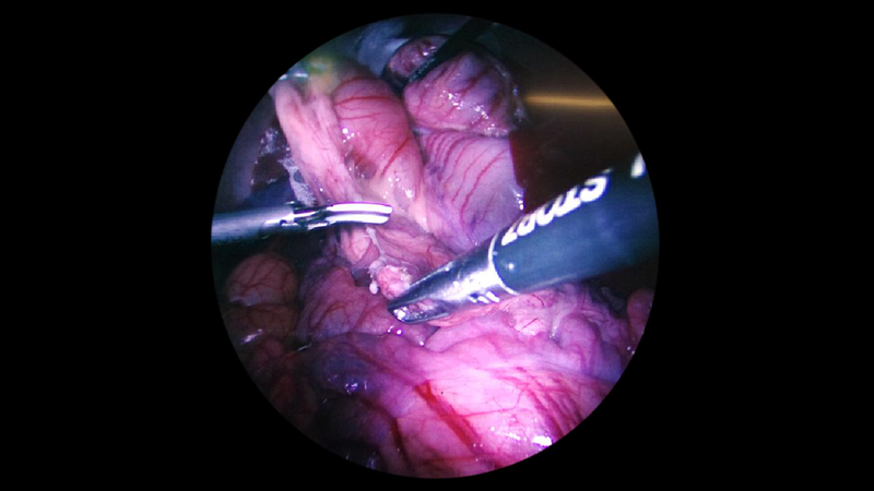 Illustration for article titled An 8K Endoscope Probably Shows More Than Anyone Really Wants To See